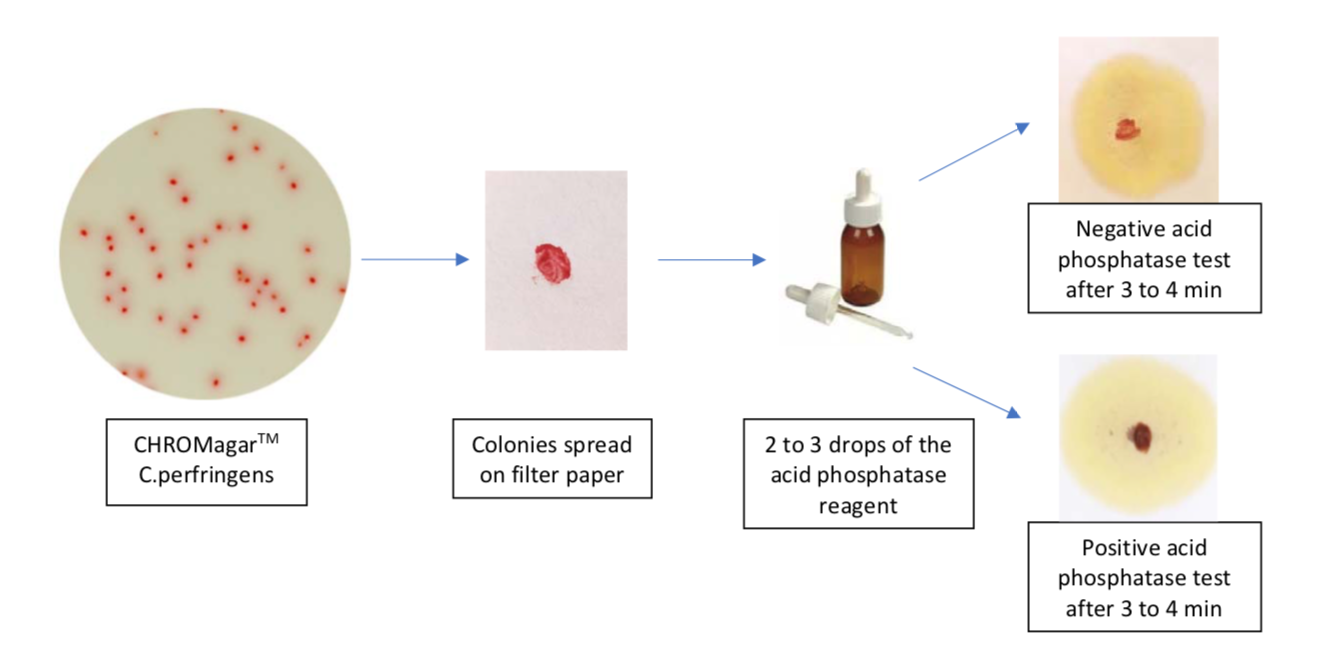 test_acid_phosphatase