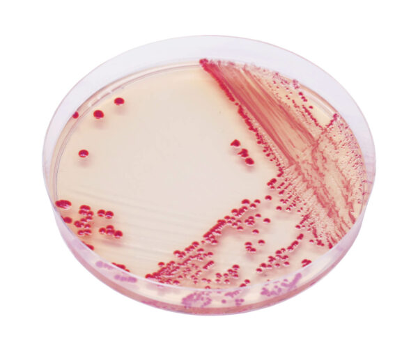 CHROMagar Acinetobacter