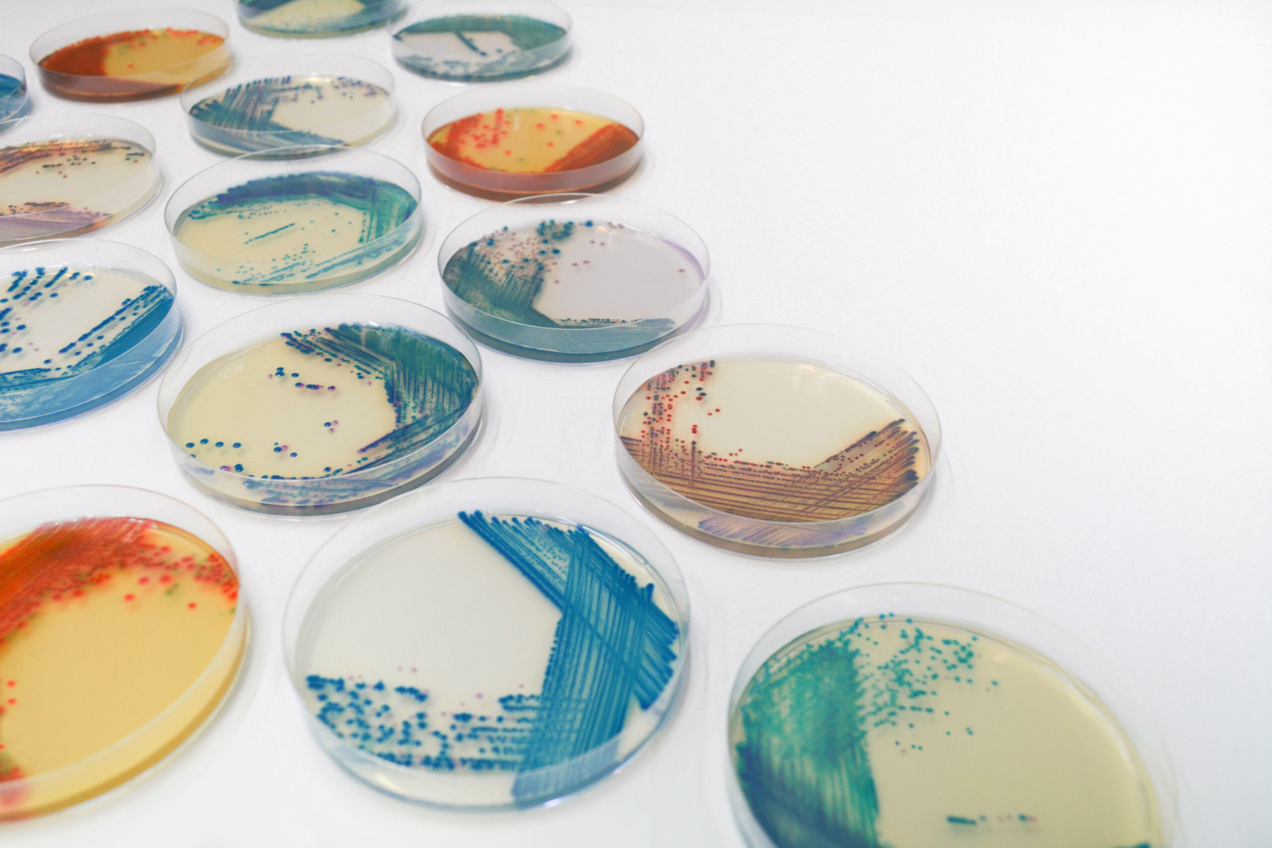 CHROMagar plates CHROMagar culture media
