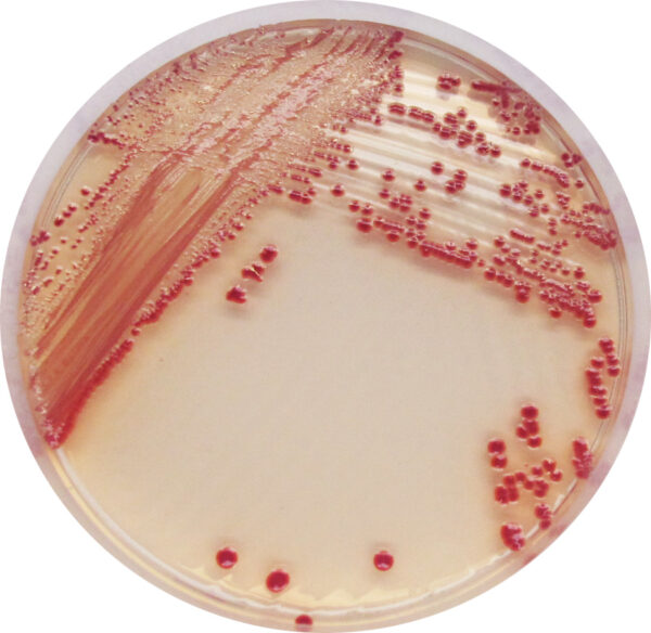 CHROMagar Acinetobacter