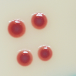 CHROMagar Acinetobacter