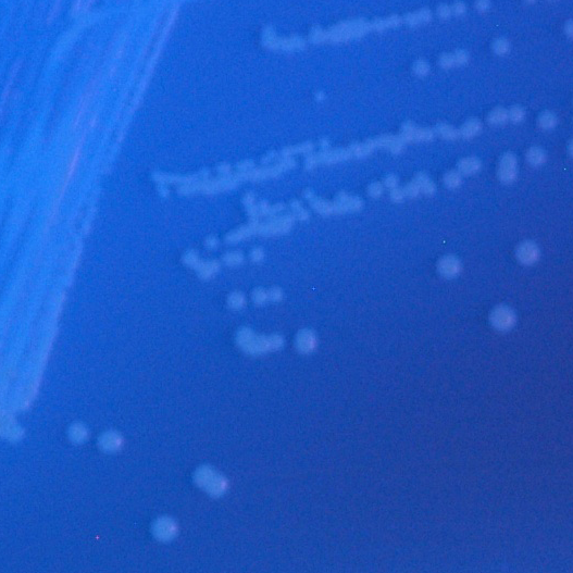 CHROMagar C.difficile other CHROMagar C.difficile other