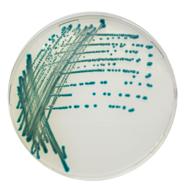 CHROMagar Serratia