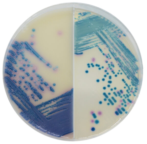 CHROMagar Mastitis