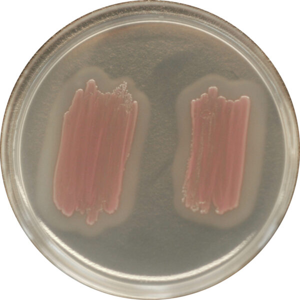 CHROMagar Identification Listeria
