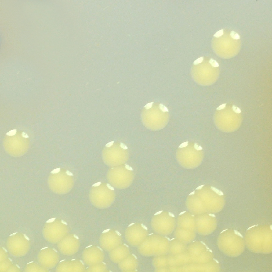 acinetobacter CHROMagar MSuperCARBA