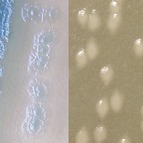 C3GR acinetobacter C3GR acinetobacter