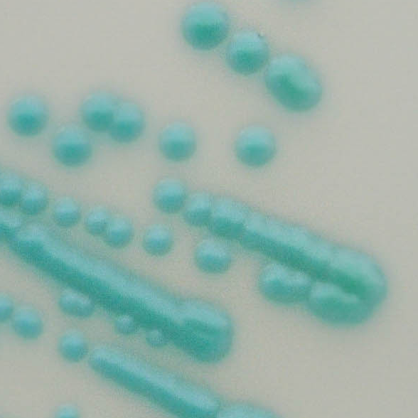 CHROMagar Candida plus calbicans CHROMagar Candida plus calbicans