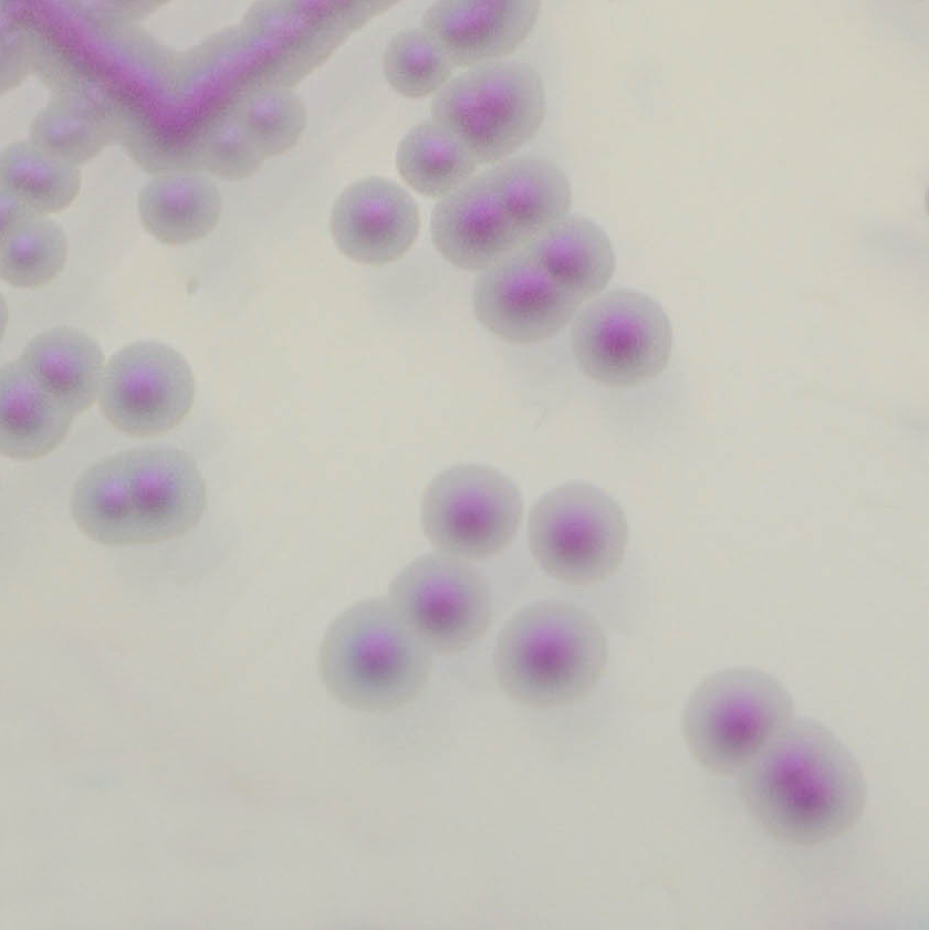 CHROMagar Candida plus ckrusei CHROMagar Candida plus ckrusei