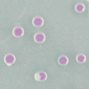 CHROMagar O157
