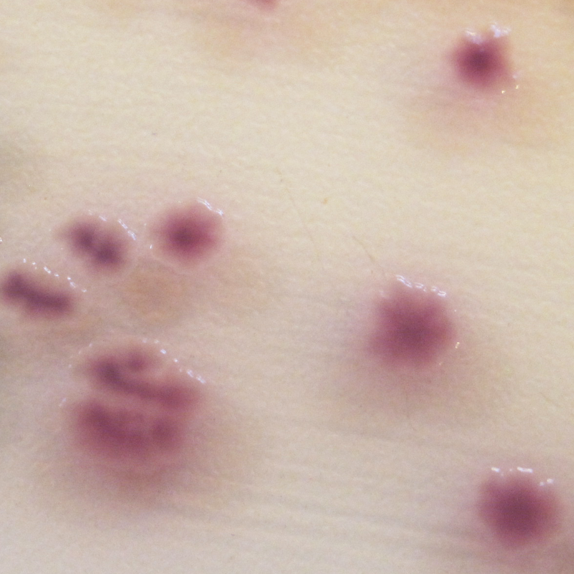 pathogen