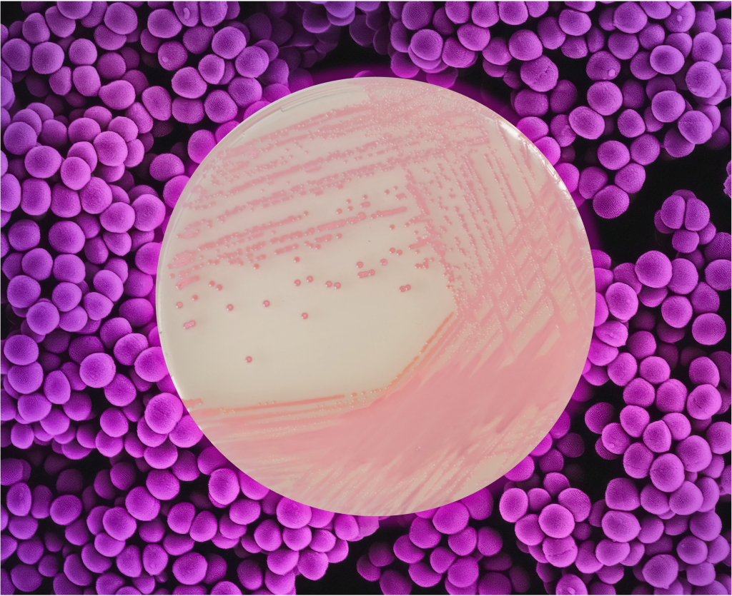 Over 20 years in the fight against AMR - Chromagar